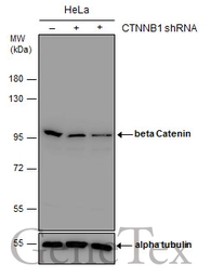 Anti-beta Catenin antibody [N1N2-2], N-term used in Western Blot (WB). GTX101435