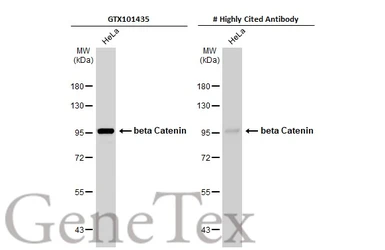 Anti-beta Catenin antibody [N1N2-2], N-term used in Western Blot (WB). GTX101435