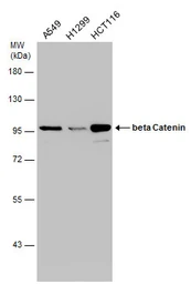 Anti-beta Catenin antibody [N1N2-2], N-term used in Western Blot (WB). GTX101435