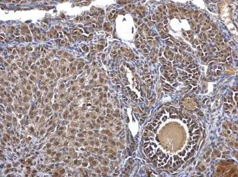 Anti-Casein Kinase 2 beta antibody used in IHC (Paraffin sections) (IHC-P). GTX101439