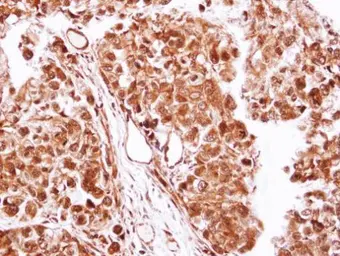 Anti-Casein Kinase 2 beta antibody used in IHC (Paraffin sections) (IHC-P). GTX101439