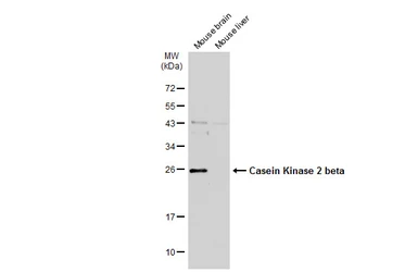 Anti-Casein Kinase 2 beta antibody used in Western Blot (WB). GTX101439