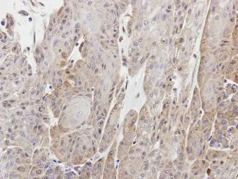 Anti-Copine 1 antibody [N3C3] used in IHC (Paraffin sections) (IHC-P). GTX101441
