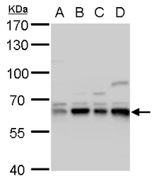 Anti-Copine 1 antibody [N3C3] used in Western Blot (WB). GTX101441