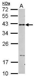 Anti-CD40 antibody used in Western Blot (WB). GTX101447