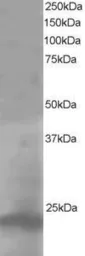 Anti-Pallidin antibody, C-term used in Western Blot (WB). GTX10145