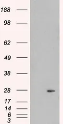 Anti-Pallidin antibody, C-term used in Western Blot (WB). GTX10145
