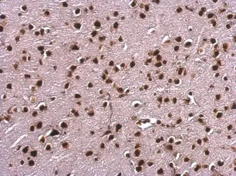 Anti-SAFB antibody used in IHC (Paraffin sections) (IHC-P). GTX101450