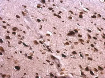 Anti-SAFB antibody used in IHC (Paraffin sections) (IHC-P). GTX101450