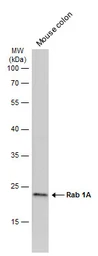 Anti-Rab 1A antibody [N1C3] used in Western Blot (WB). GTX101454