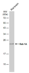 Anti-Rab 1A antibody [N1C3] used in Western Blot (WB). GTX101454