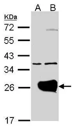 Anti-Rab 1A antibody [N1C3] used in Western Blot (WB). GTX101454