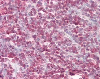 Anti-Cystatin B antibody used in IHC (Paraffin sections) (IHC-P). GTX101458