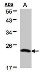 Anti-BTF3 antibody [N1C3] used in Western Blot (WB). GTX101462