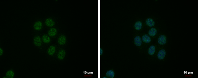 Anti-SFRS9 antibody used in Immunocytochemistry/ Immunofluorescence (ICC/IF). GTX101465