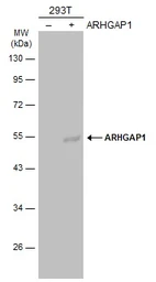 Anti-ARHGAP1 antibody [N3C3] used in Western Blot (WB). GTX101471