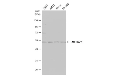 Anti-ARHGAP1 antibody [N3C3] used in Western Blot (WB). GTX101471