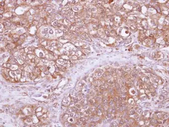 Anti-ARHGAP1 antibody [N3C3] used in IHC (Paraffin sections) (IHC-P). GTX101471