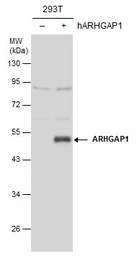 Anti-ARHGAP1 antibody [N1N3] used in Western Blot (WB). GTX101472
