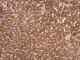 Anti-Transketolase antibody [N3C2], Internal used in IHC (Paraffin sections) (IHC-P). GTX101477