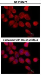 Anti-Transketolase antibody [N3C2], Internal used in Immunocytochemistry/ Immunofluorescence (ICC/IF). GTX101477