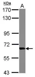 Anti-Transketolase antibody [N3C2], Internal used in Western Blot (WB). GTX101477