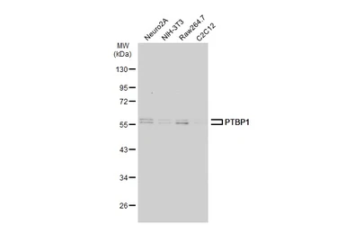 Anti-PTBP1 antibody used in Western Blot (WB). GTX101481