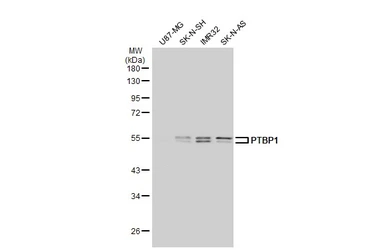 Anti-PTBP1 antibody used in Western Blot (WB). GTX101481