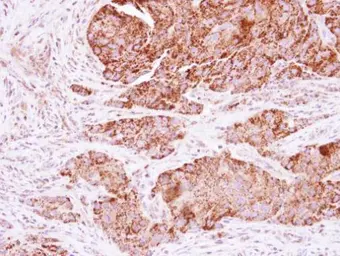 Anti-C21orf33 antibody used in IHC (Paraffin sections) (IHC-P). GTX101483