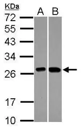 Anti-C21orf33 antibody used in Western Blot (WB). GTX101483