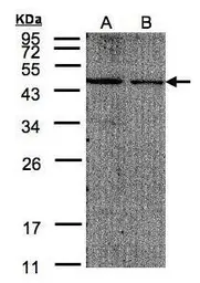 Anti-EIF4A2 antibody used in Western Blot (WB). GTX101485