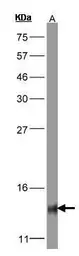 Anti-COX5B antibody [N1C3] used in Western Blot (WB). GTX101486
