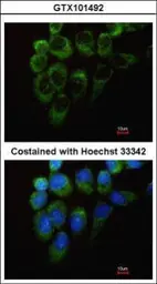 Anti-Tyrosyl tRNA synthetase antibody used in Immunocytochemistry/ Immunofluorescence (ICC/IF). GTX101492