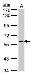 Anti-Tyrosyl tRNA synthetase antibody used in Western Blot (WB). GTX101492