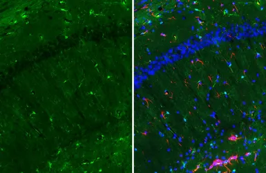 Anti-Iba1 antibody used in IHC (Frozen sections) (IHC-Fr). GTX101495