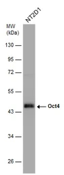 Anti-Oct4 antibody used in Western Blot (WB). GTX101497