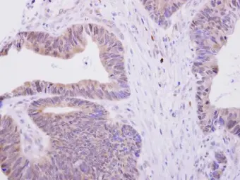 Anti-H6PD antibody [N2N3] used in IHC (Paraffin sections) (IHC-P). GTX101500
