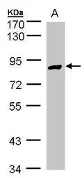 Anti-H6PD antibody [N2N3] used in Western Blot (WB). GTX101500