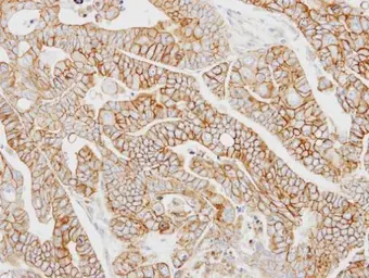 Anti-AP2M1 antibody used in IHC (Paraffin sections) (IHC-P). GTX101502