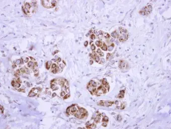 Anti-ATP5D antibody used in IHC (Paraffin sections) (IHC-P). GTX101503