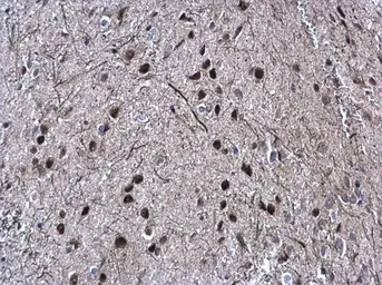 Anti-SOX2 antibody [N1C3] used in IHC (Paraffin sections) (IHC-P). GTX101507