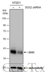 Anti-SOX2 antibody [N1C3] used in Western Blot (WB). GTX101507