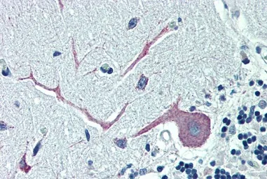Anti-ORP1 antibody, C-term used in IHC (Paraffin sections) (IHC-P). GTX10151