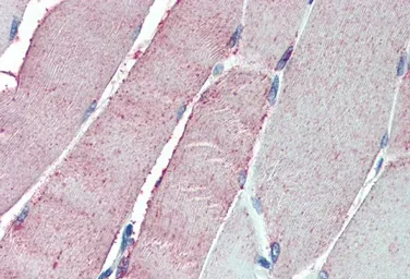 Anti-ORP1 antibody, C-term used in IHC (Paraffin sections) (IHC-P). GTX10151