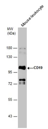 Anti-CD19 antibody [C1C3] used in Western Blot (WB). GTX101512