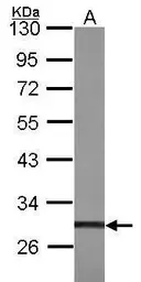 Anti-TIS11B antibody [N1C1] used in Western Blot (WB). GTX101518