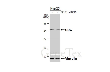 Anti-ODC antibody [N3C3] used in Western Blot (WB). GTX101521