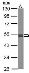 Anti-SEPT7 antibody [N3C3] used in Western Blot (WB). GTX101533