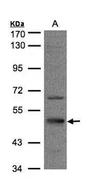 Anti-SEPT7 antibody [N3C3] used in Western Blot (WB). GTX101533