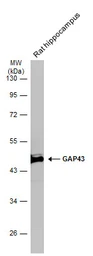 Anti-GAP43 antibody used in Western Blot (WB). GTX101535